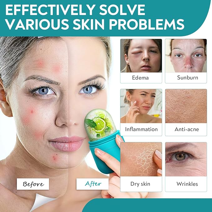 AURUZA Ice Face Roller and Gua Sha Set, Facial Ice Roller & Gua Sha Massage Tool for Face & Eye Puffiness Relief, Shrink Pores, Improve Skin Condition