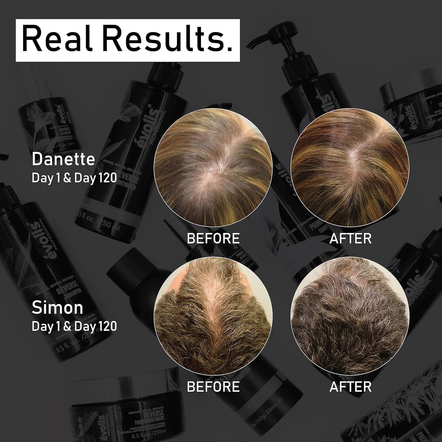 EVOLIS PREVENT Shampoo & Conditioner - Anti Hair Loss Treatment for Men and Women - Preventative Hair Loss Shampoo & Thickening Conditioner