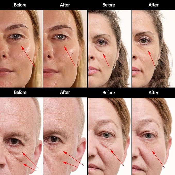 Puffy Eye Treatment Instant results – Naturally Eliminate Wrinkles, Puffiness, Dark Circle and Bags in Minutes – Hydrating Eye Cream w/ Green Tea Extract, Dead Sea Minerals by SEAMANTIKA – .8 fl.oz.