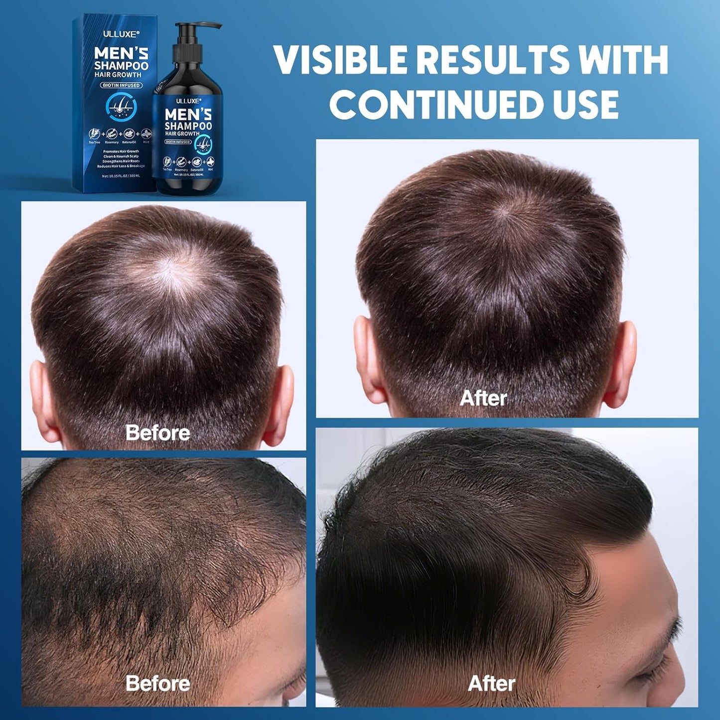 Biotin Hair Growth Shampoo for Men: Natural Mens Thickening Shampoo for Hair Loss and Thinning Hair, Infused Rosemary Oil Tea Tree Oil and Mint, Sulfate Free and Color Safe, 10.15 fl.oz