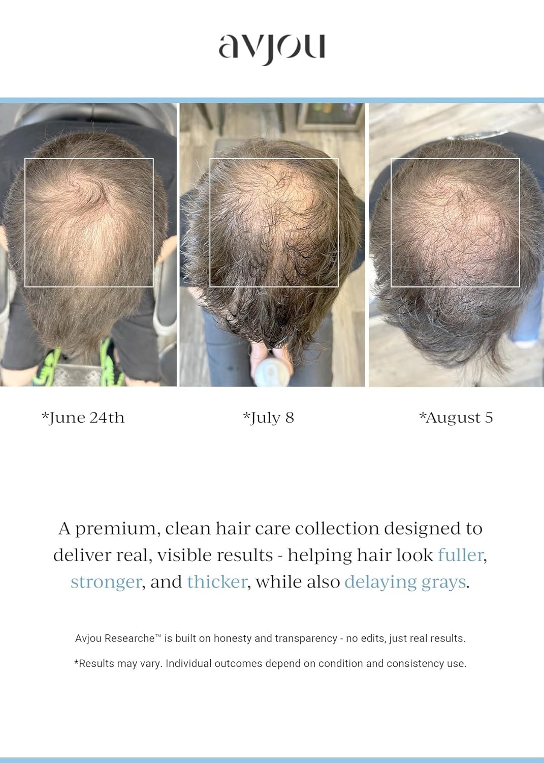 Avjou Researche™ Scalp Serum – Thicker, Fuller-Looking Hair + Targets Visible Signs of Premature Greying – 3 Patented Ingredients – Backed by Cosmetic Science – Oil-Free, All Hair Types, 1.7 oz