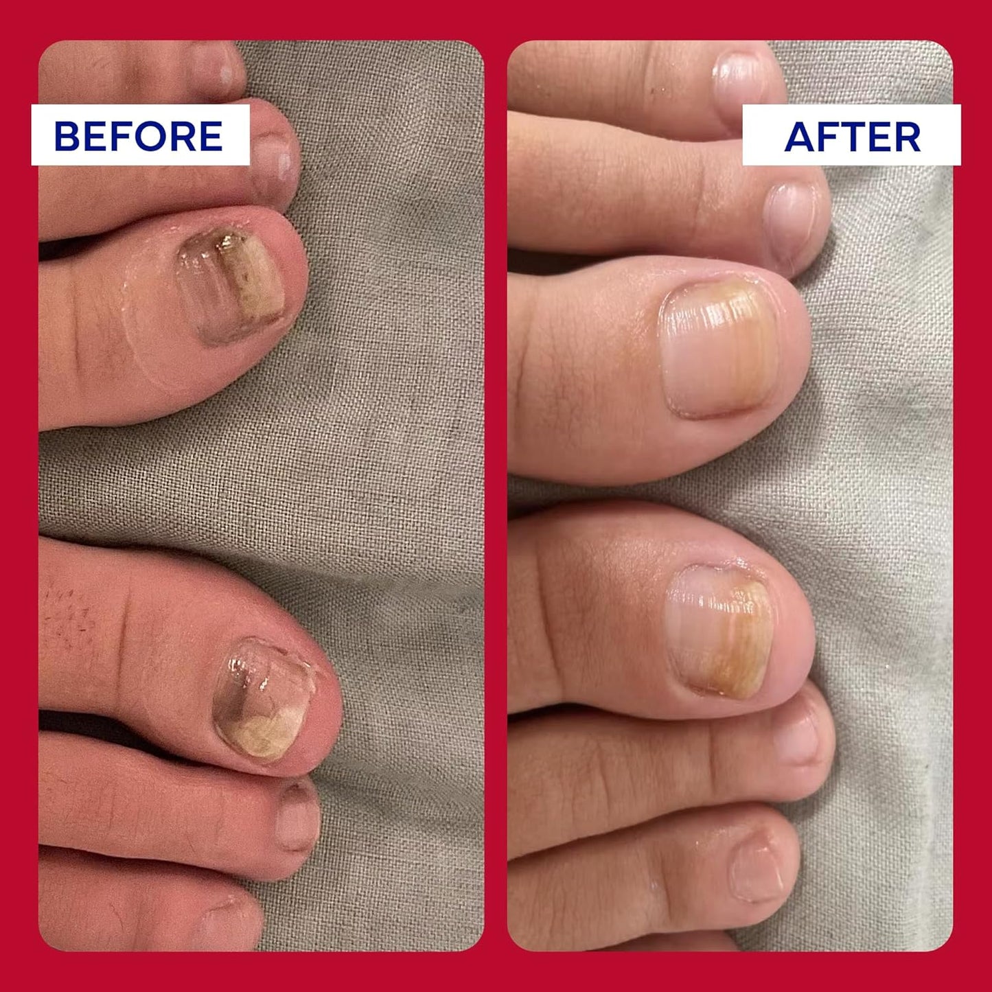 EMUAIDMAX Homeopathic Psoriasis Scalp Treatment Serum – Natural First Aid Concentrate for Dry, Itchy Scalp Relief and Skin Irritations from Psoriasis, Eczema, and Dermatitis, 1oz