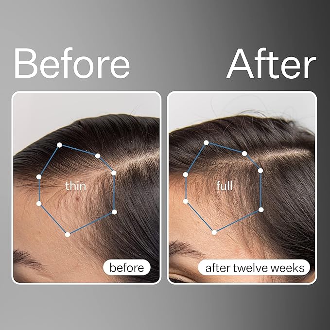 ACT+ ACRE Cold Processed Stem Cell Scalp Serum - Promotes Thicker and Fuller-Looking Hair - Soothes and Hydrates the Scalp - Sulphate and Paraben Free - Aloe Vera for Improved Scalp Health - 1 fl oz.