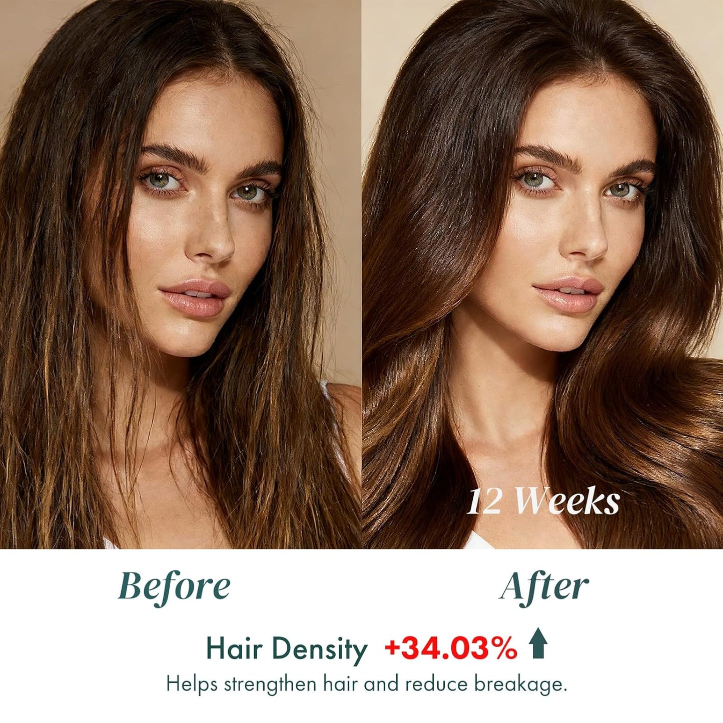 ALFHEIM Saw Palmetto Scalp Serum for Boost Follicle - Infused With Caffeine, Biotin for Thicker Hair - Balance Scalp, Rejuvenate Hair Follicles ＆ Improve Hair Density - 1.69 fl oz + Serum Applicator