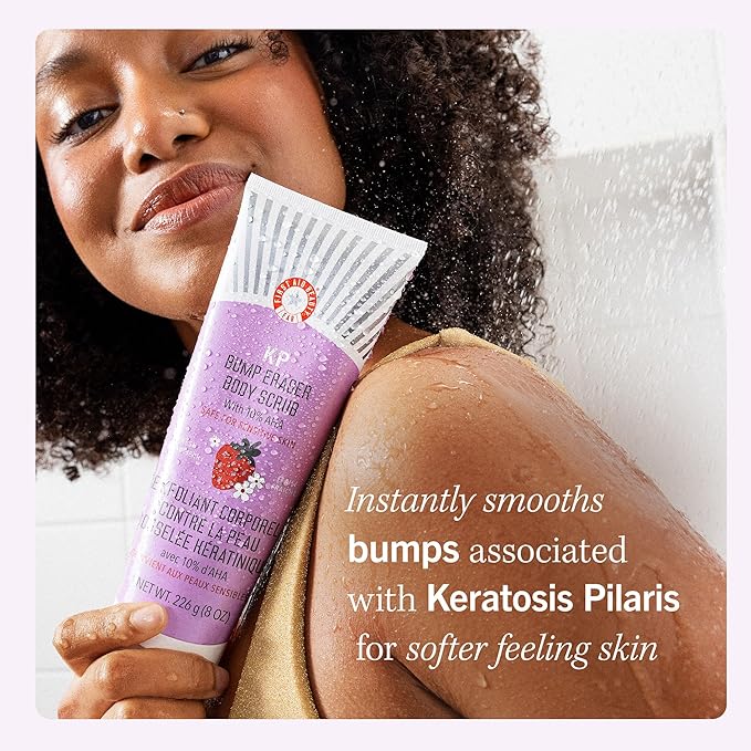 First Aid Beauty - KP Bump Eraser Body Scrub with 10% AHA, Keratosis Pilaris Exfoliator with Glycolic and Lactic acids, Helps Reduce Chicken Skin Bumps, Safe for Sensitive Skin, Strawberry Scent, 2 oz