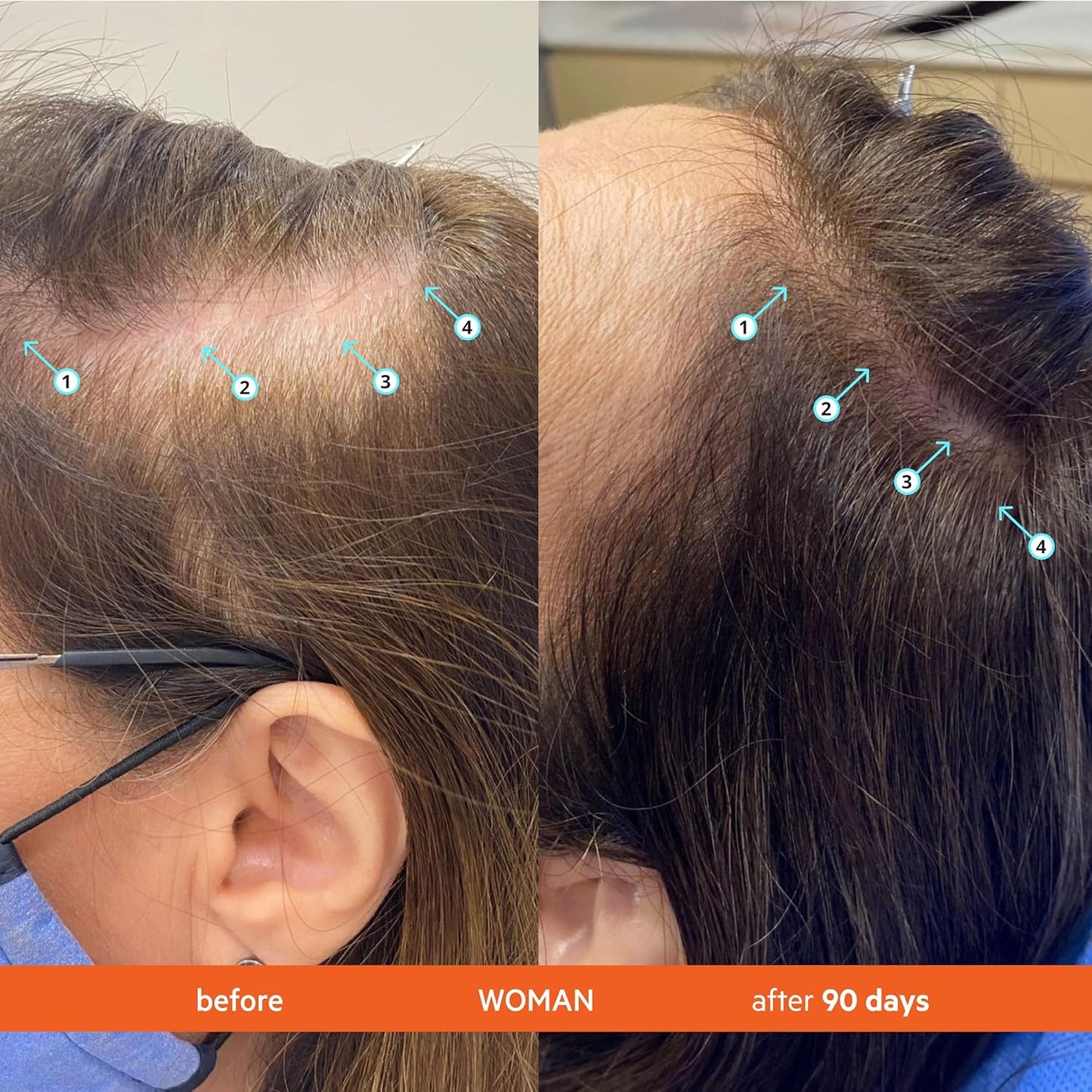 DS Labs Revita Conditioner, 100 mL – Scalp Refreshing Hydration for Fuller Looking, Weightless Hydration, Caffeine, Turmeric, Sulfate & Silicone Free, Color Safe, For Men & Women