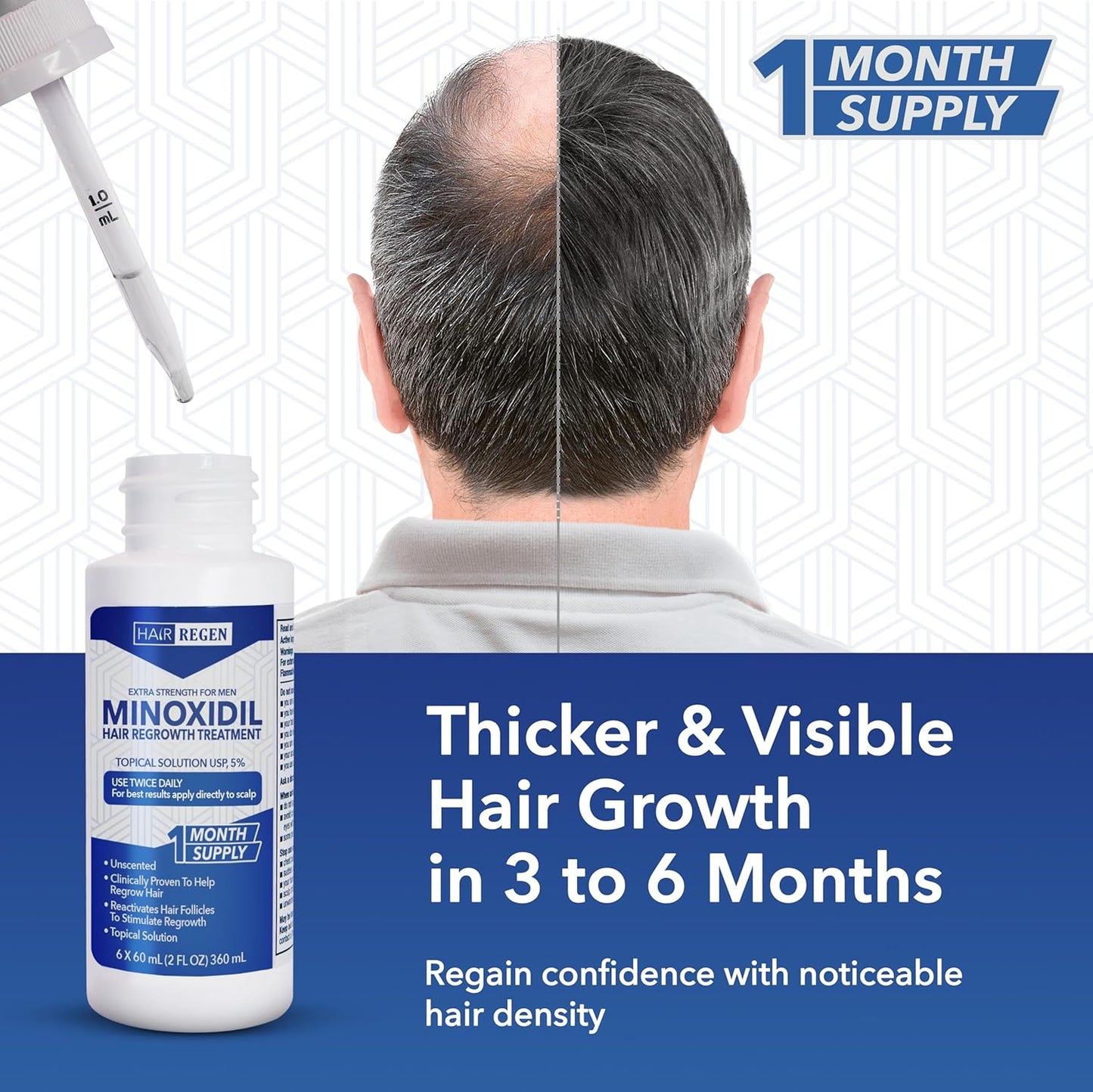 Hair-Regen Advanced 5% Minoxidil For Men Hair Regrowth Treatment for Thinning Hair - Hair Loss for Men - 6 Month Supply, Minoxidil Topical Solution So Thicker Fuller Hair Keeps Growing Amazing Results