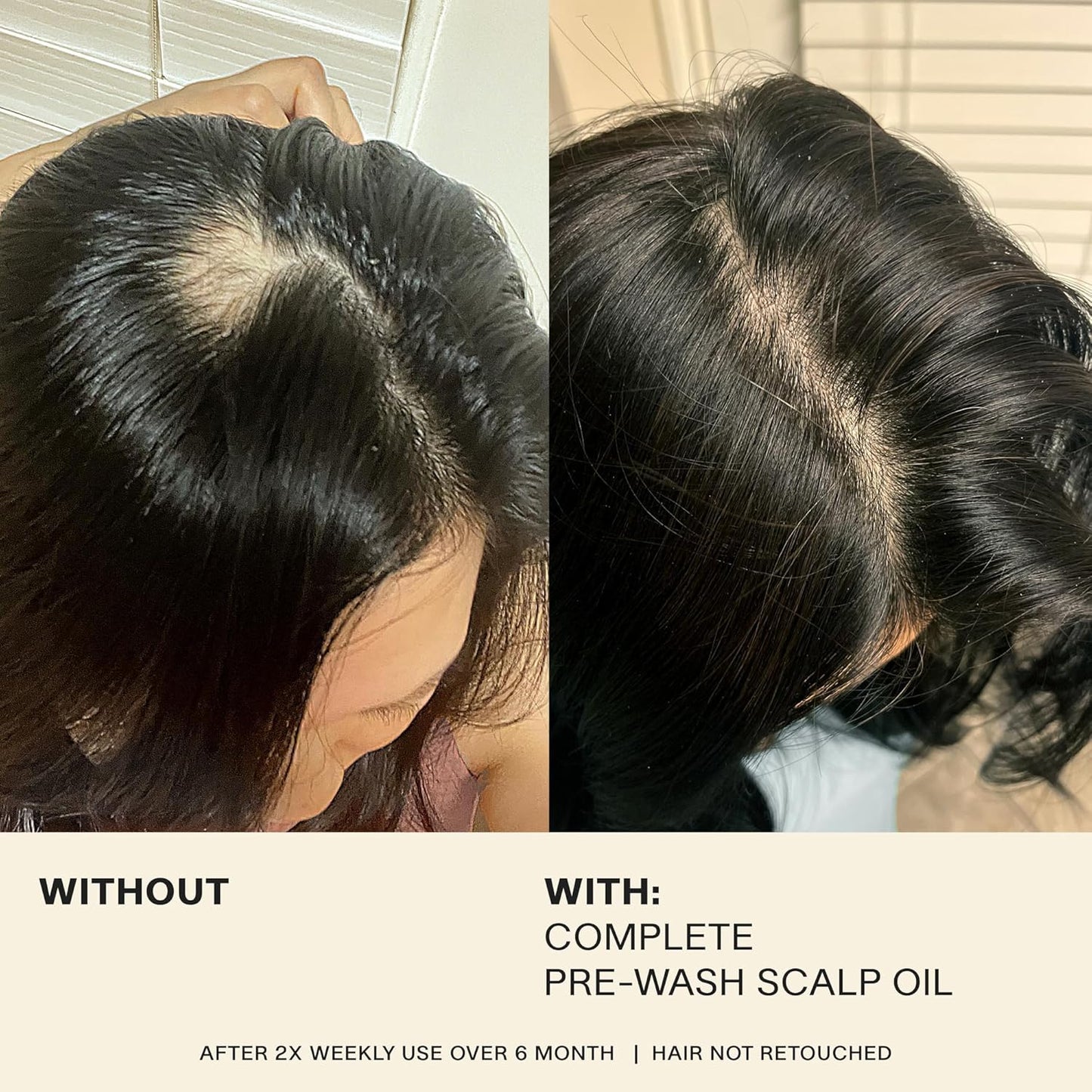 JVN Complete Pre-Wash Scalp Oil, 1.7 Fl Oz, Hair Treatment and Scalp Clarifying Oil Made with Rosemary Extract, Hair Care for Women and Men, Silicone Free