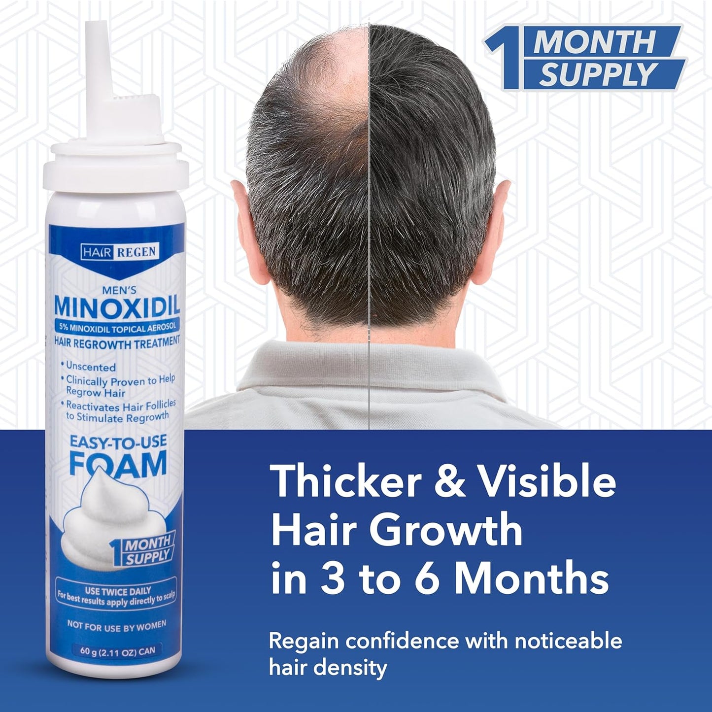 5% Minoxidil Foam for Men 1 Pack - Men's 5 Percent Hair Growth Treatment - Topical Foaming Minoxidil for Men 1 Month Supply - Great for Hair Regrowth and Reduce Hair Loss