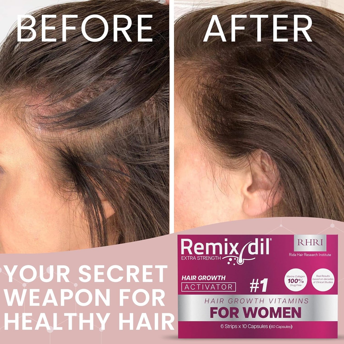 Hair Growth Vitamins for Visibly Thicker & Stronger Hair - Supplements for Hair Loss Treatment and Thinning Hair in Women