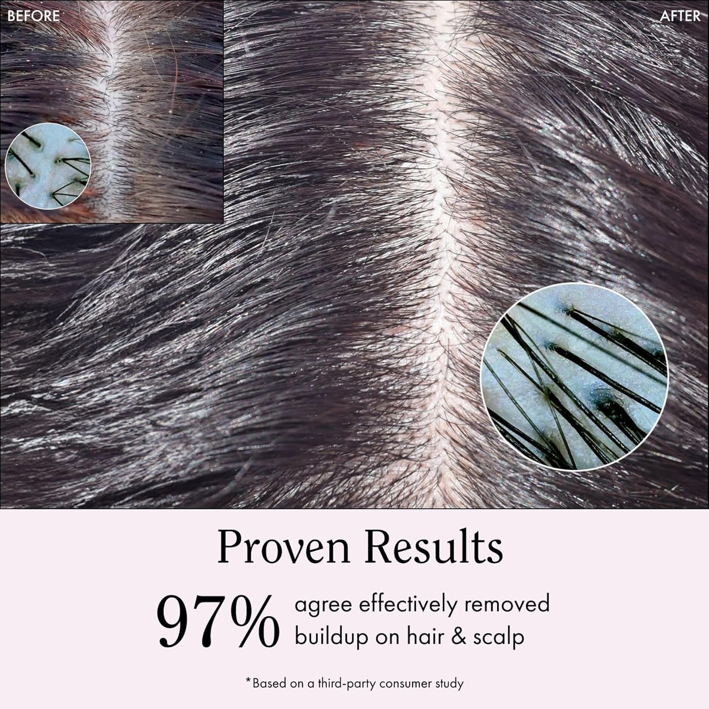 Rizos Curls Apple Cider Vinegar Scalp & Hair Rinse, Clarifies to Remove Product Buildup, Balance Oils, Revive Hair & Scalp, Enhances Softness & Shine, 10 oz