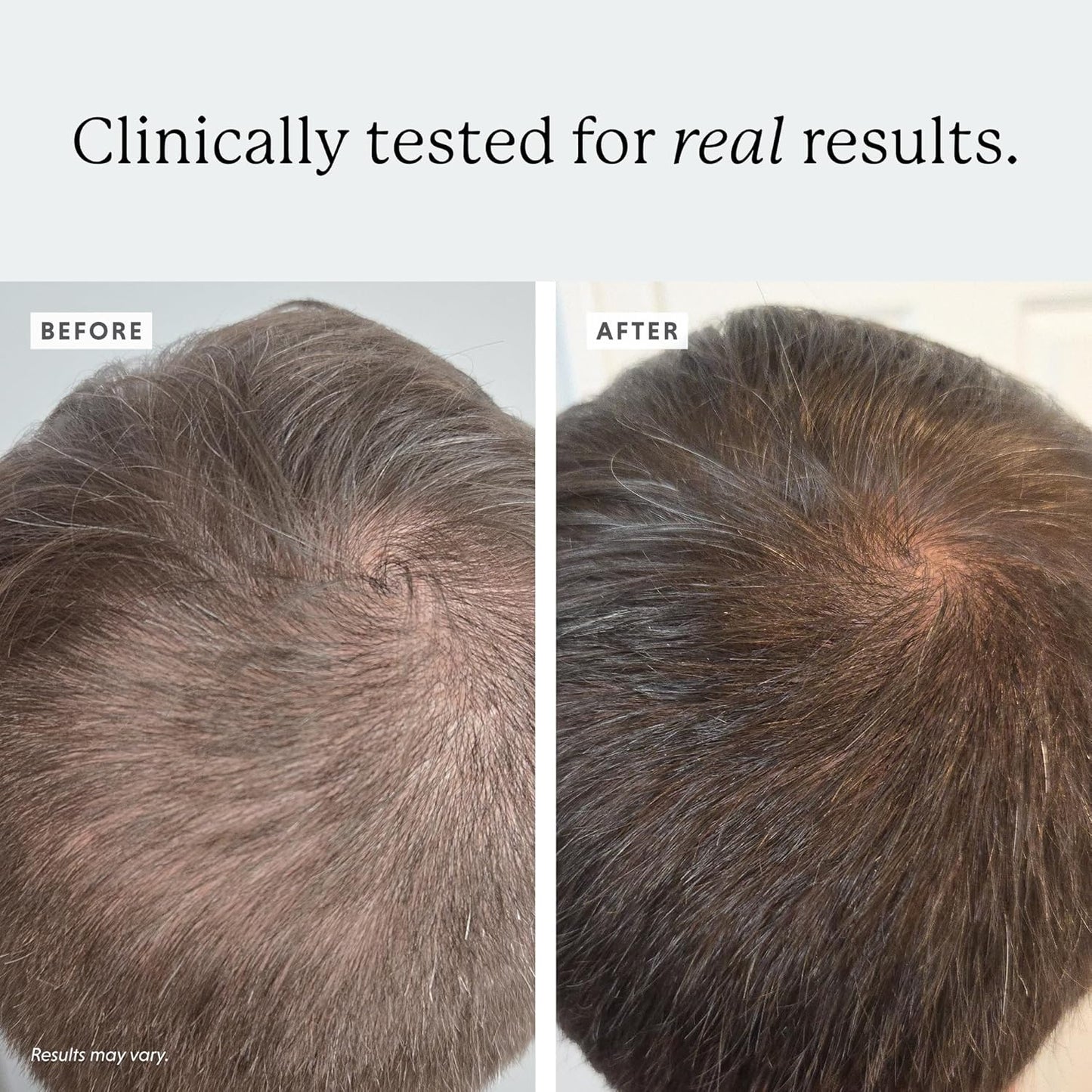 Densifying Scalp Serum, 1 fl oz, with Procapil and Redensyl