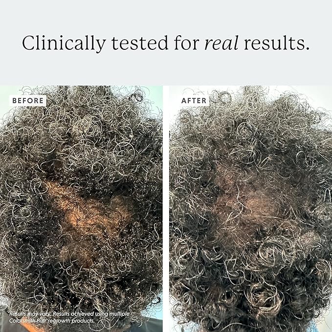 Biotin Hair Multivitamins, 2500mcg Biotin with Collagen, 60 Capsules, 30 Day Supply