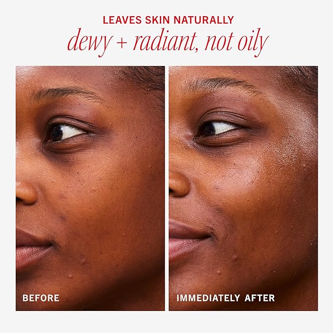 First Aid Beauty - Hydrating Dewy Gel Cream, Lightweight Oil-Free Facial Moisturizer with Hyaluronic Acid and Ceramides, Helps Reduce Excess Oil Build Up & Improve Skins Hydration, 1.7 oz