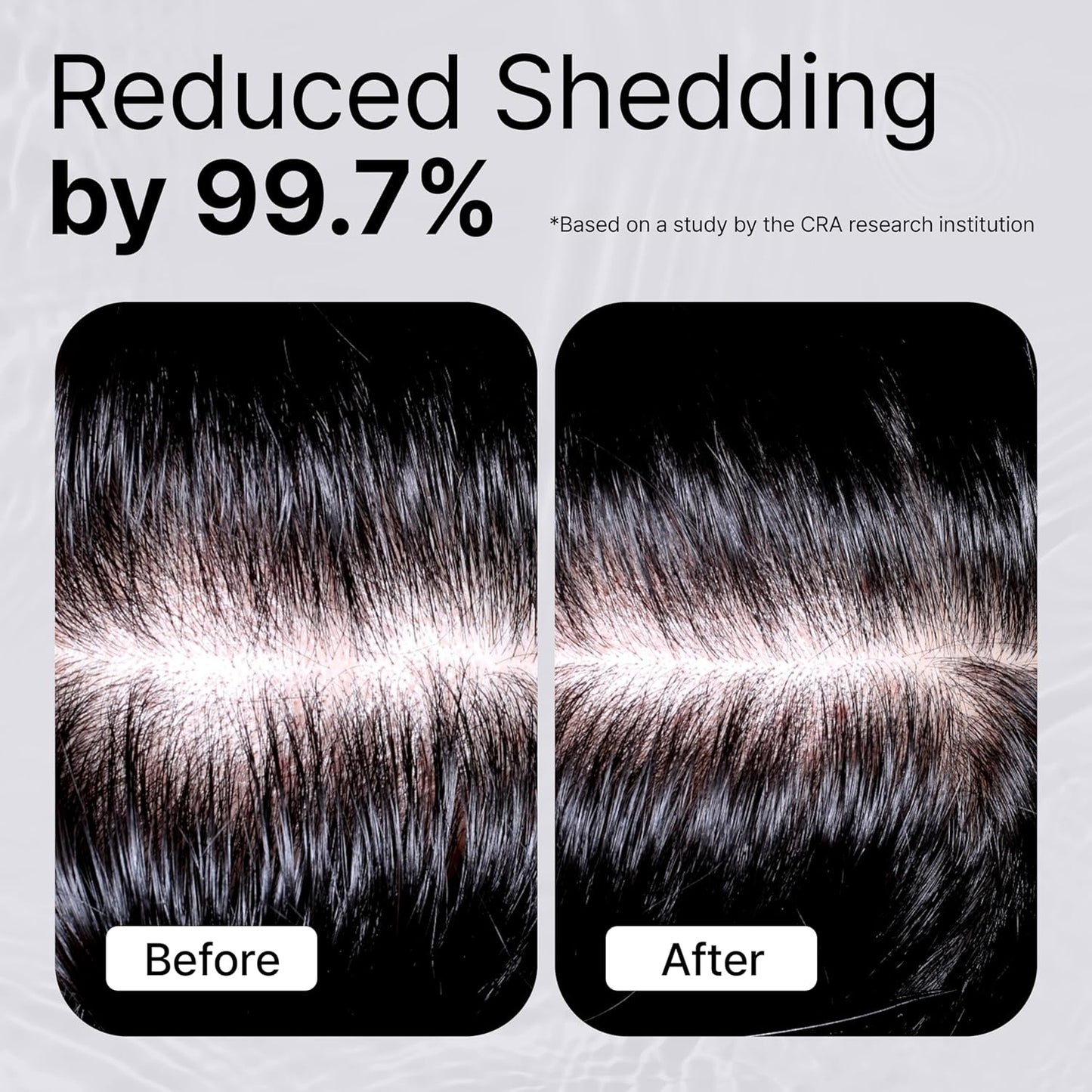 REFILLED Booster Plus Moisture | Hair Growth Serum & Thickening Scalp Treatment with Built-in Massager for Men & Women | Hair Loss & Thinning | Fuller & Baby Hair Regrowth | Fast-Absorbing with Biotin