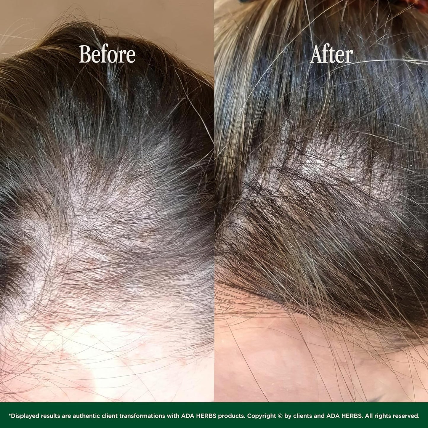 | 100% Natural Pre-Shower/Overnight Hair Oil Mask, Hair Treatment - Cold Pressed Oils, Vit. E, Squalane from Olive, (8.45 Fl. Oz.)